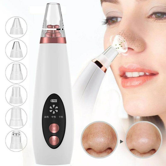 Acne And blackhead Suction Tool | Blackhead And Whitehead Remover
