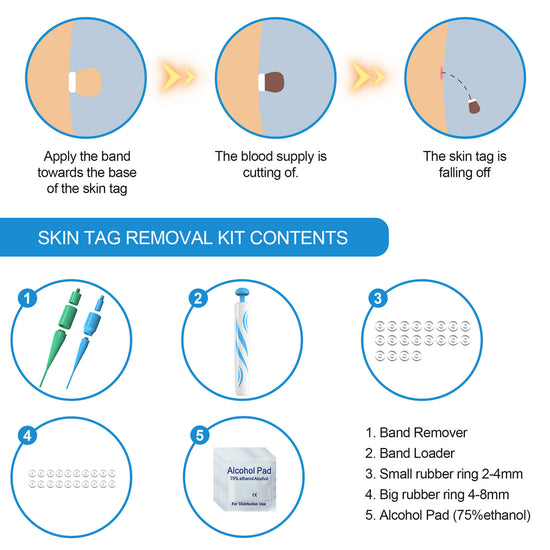 Best Skin Tag Removal Tool For Home Use | Skin Tag Remover Device