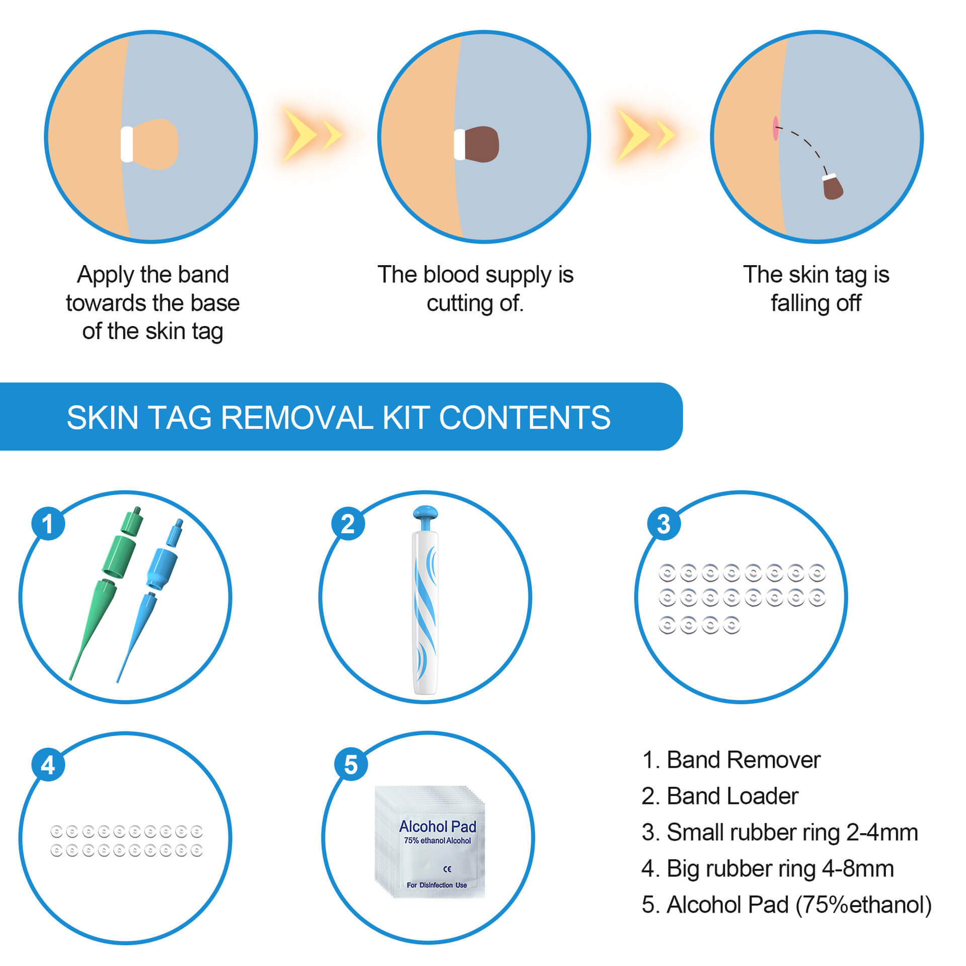Best Skin Tag Removal Tool For Home Use | Skin Tag Remover Device