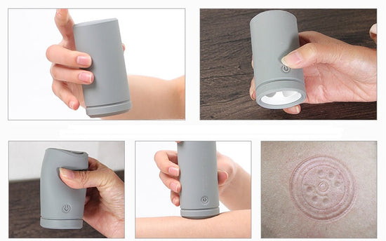 Electric Silicone Cupping Therapy Massager For Back Pain  EMS Cupping
