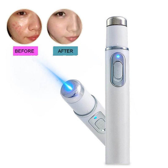 Heated Eye Massager For Dark Circles | Acne Removal Pen Skincare Tool