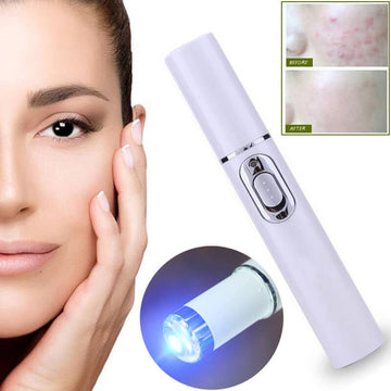 Heated Eye Massager For Dark Circles | Acne Removal Pen Skincare Tool